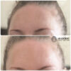 اسنس ضد آفتاب ترافل سفید د البا ضد چروک و جوانساز پوست D’Alba Waterfull Essence Sun Cream