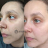 اسنس ضد چروک کمپلکس 9 پپتاید مدی پیل حجم دهنده و آبرسان قوی پوست Medi-Peel All in One Peptide 9 Volume Essence