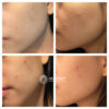 فوم شستشوی کنترل منافذ مدی کیوب Medicube Zero Foam Cleanser
